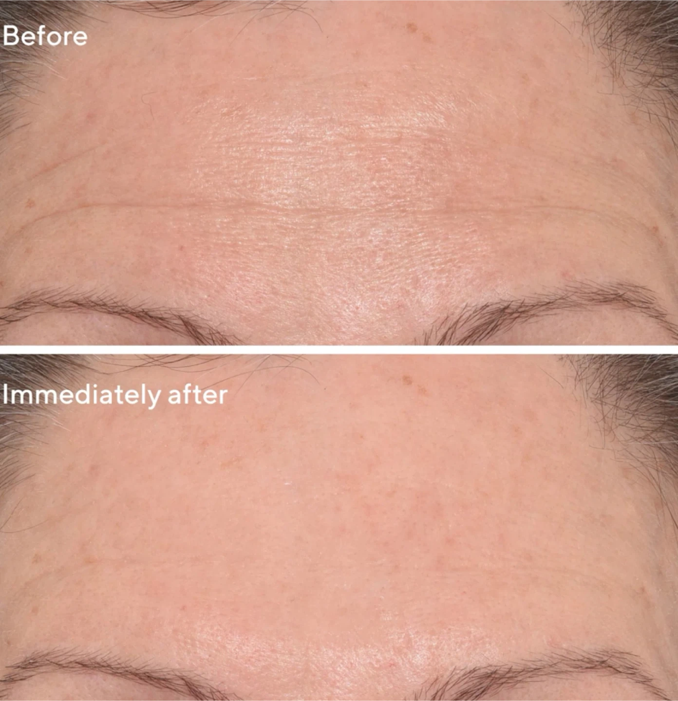 Murad Resurgence Targeted Wrinkle Corrector - photo 2