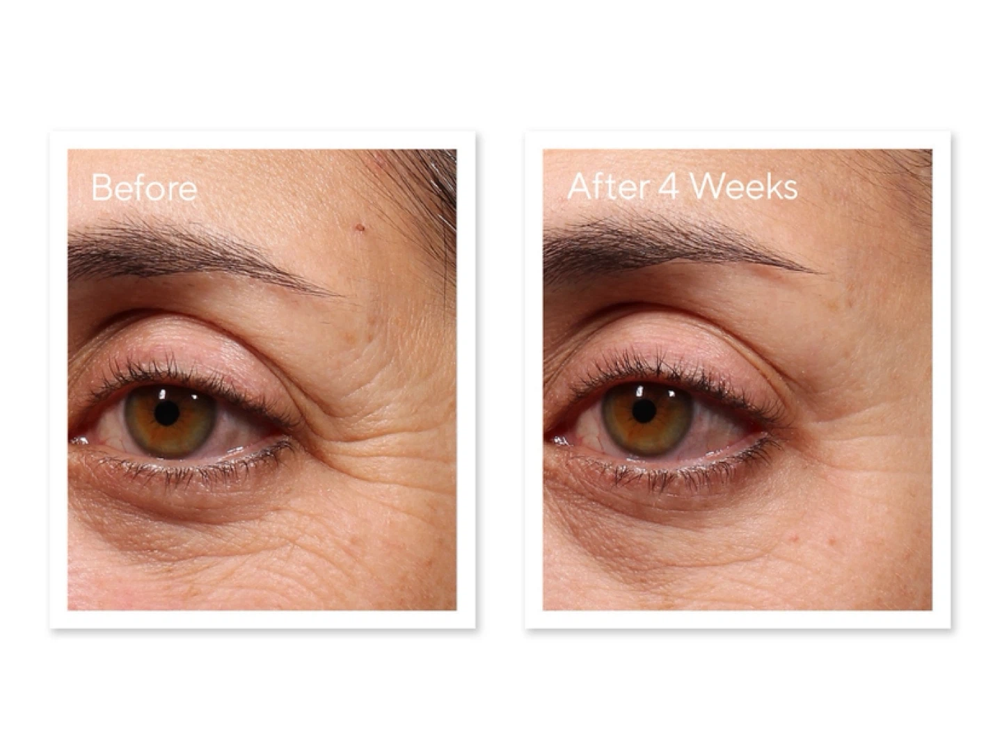 Murad Retinol Youth Renewal Eye Serum - photo 5