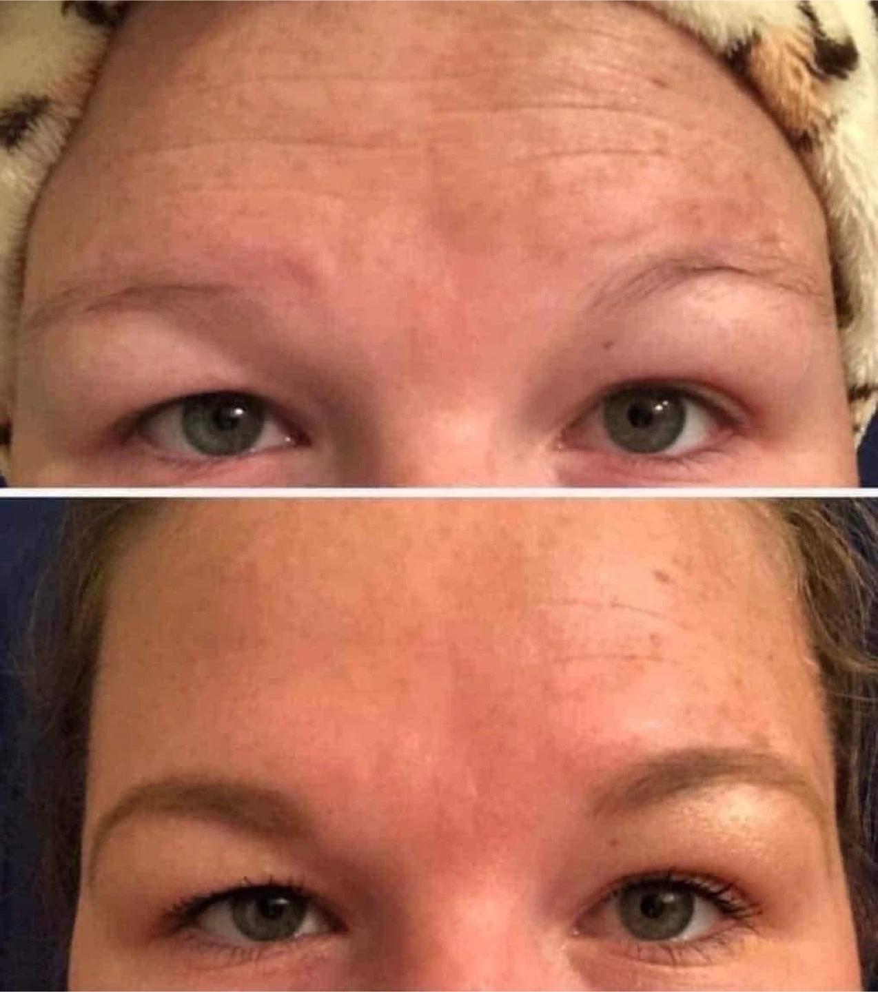 Nu Skin Tru Face Line Corrector