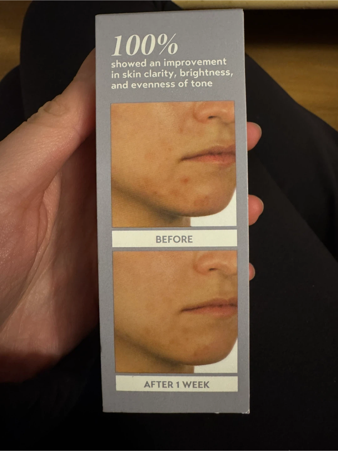 Shani Darden Skin Care 10% Azelaic Complex Serum - photo 2