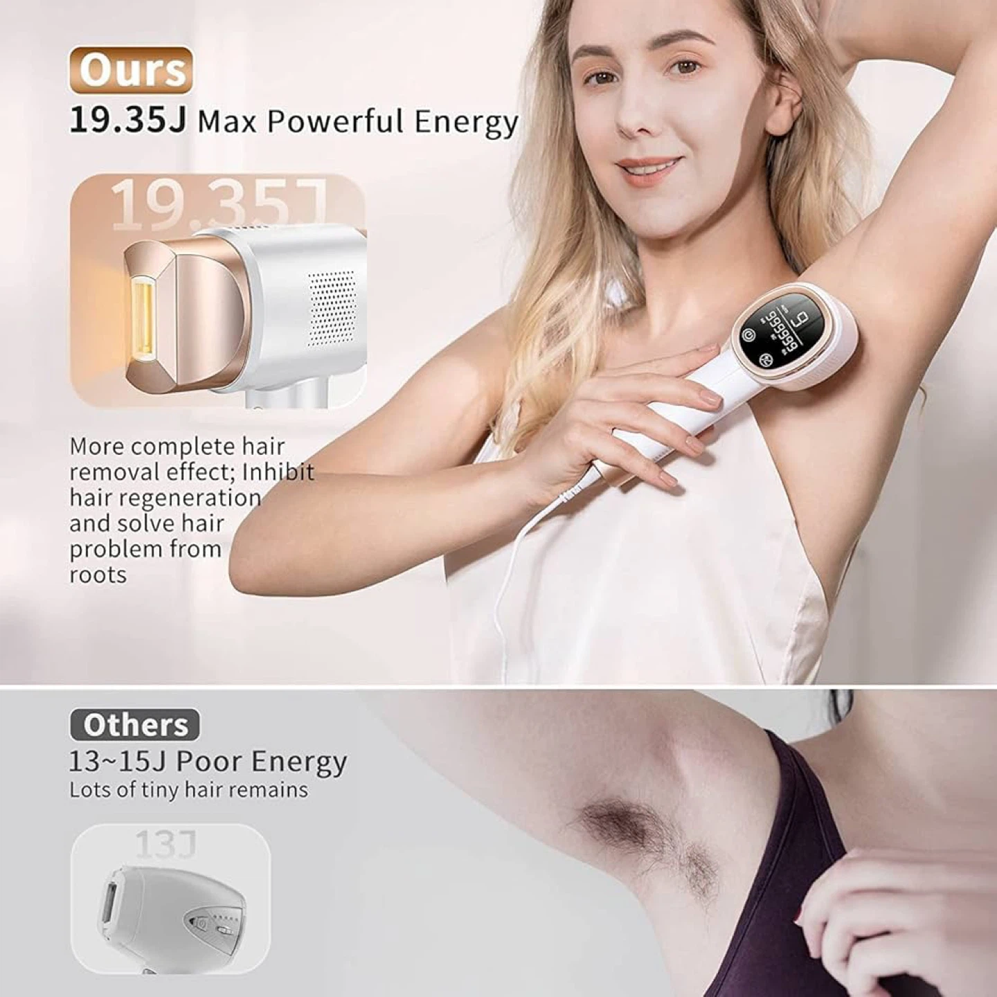 IPL Hair Removal Device - FZ-608 - photo 2