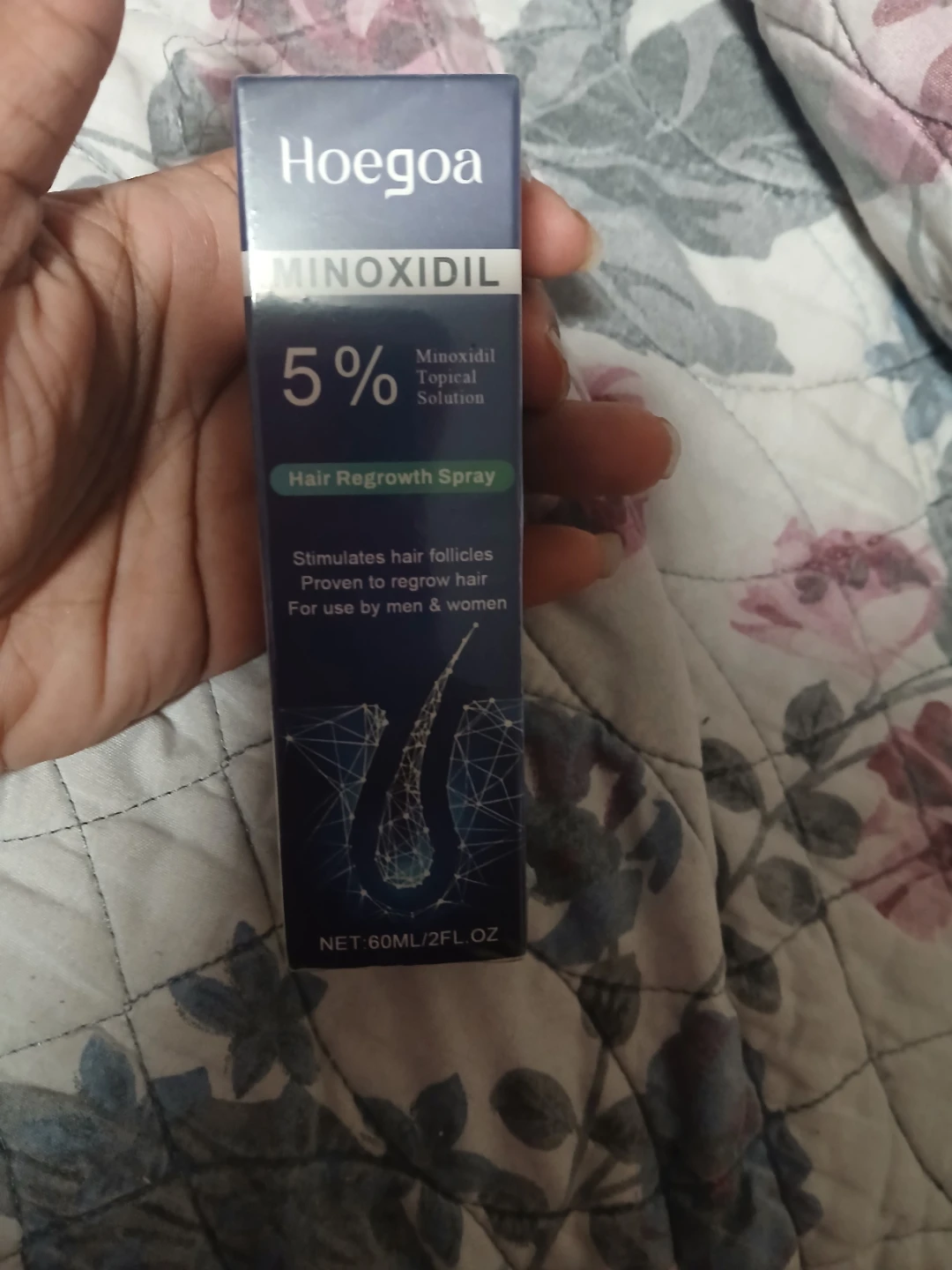 Hoegoa Minoxidil 5% Hair Regrowth Spray expires 2028