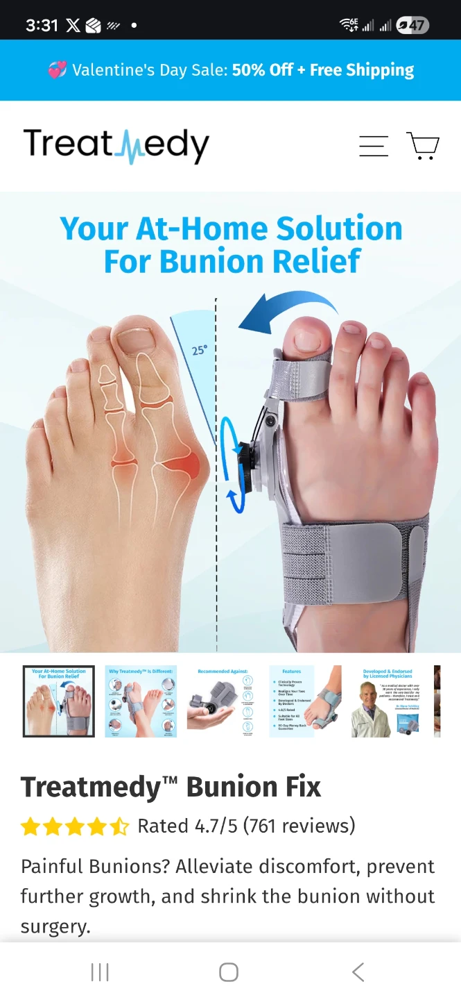Treatment bunion fix