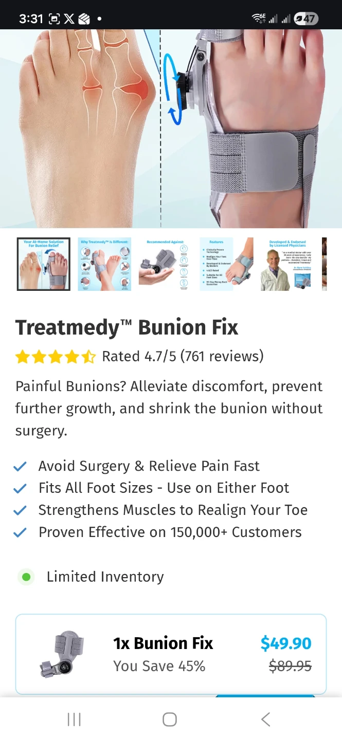 Treatment bunion fix - photo 2