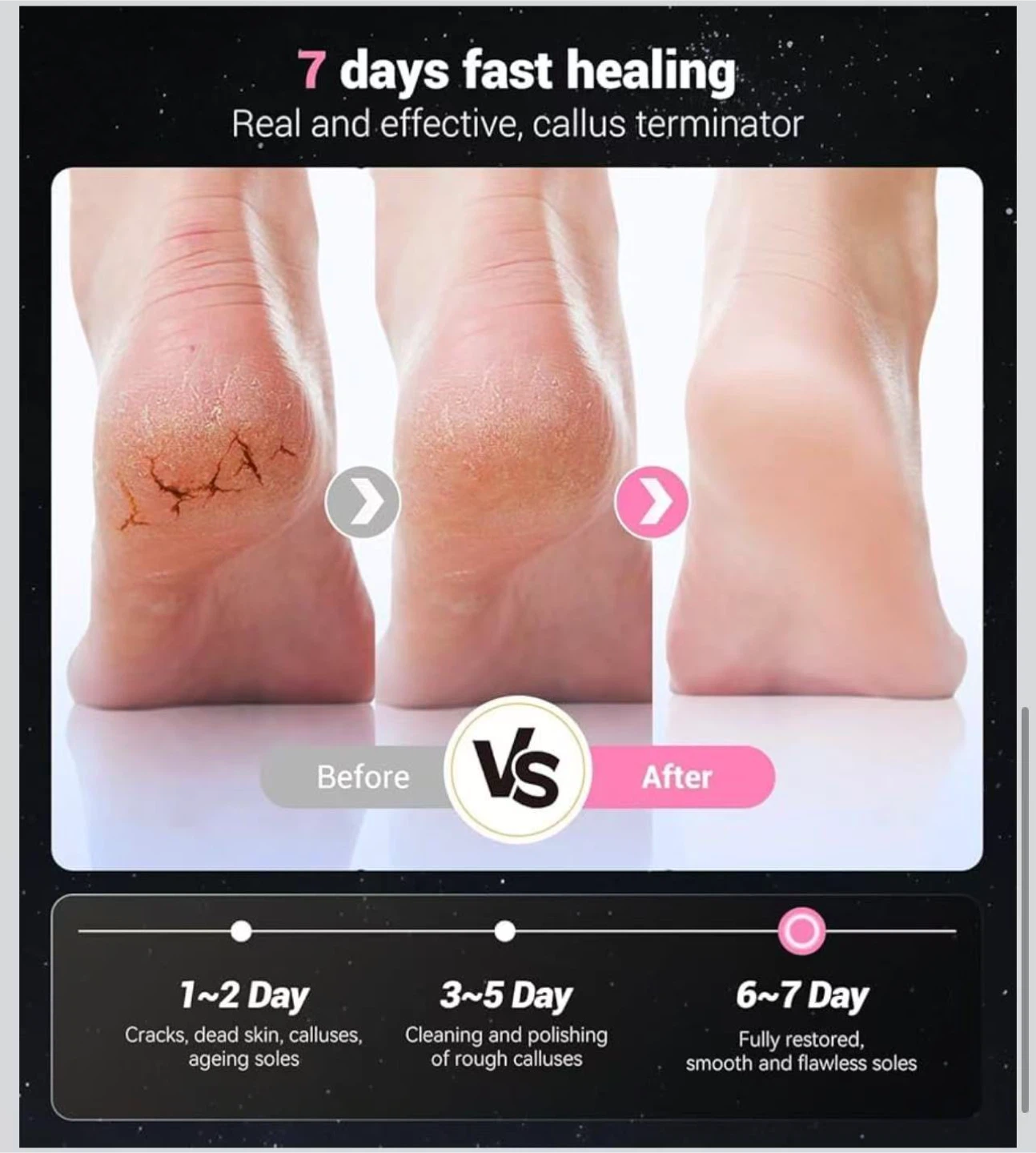 Electric Callus Remover 9 Adjustable Speeds - photo 5