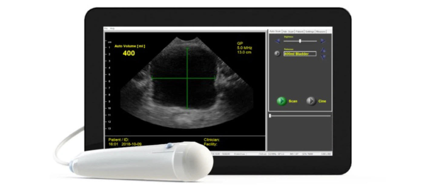 Interson Viewbladder Scanner with Stand - photo 2