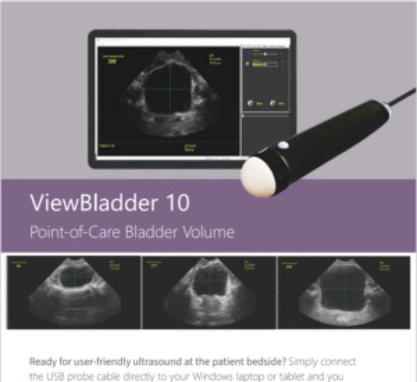 Interson Viewbladder Scanner with Stand