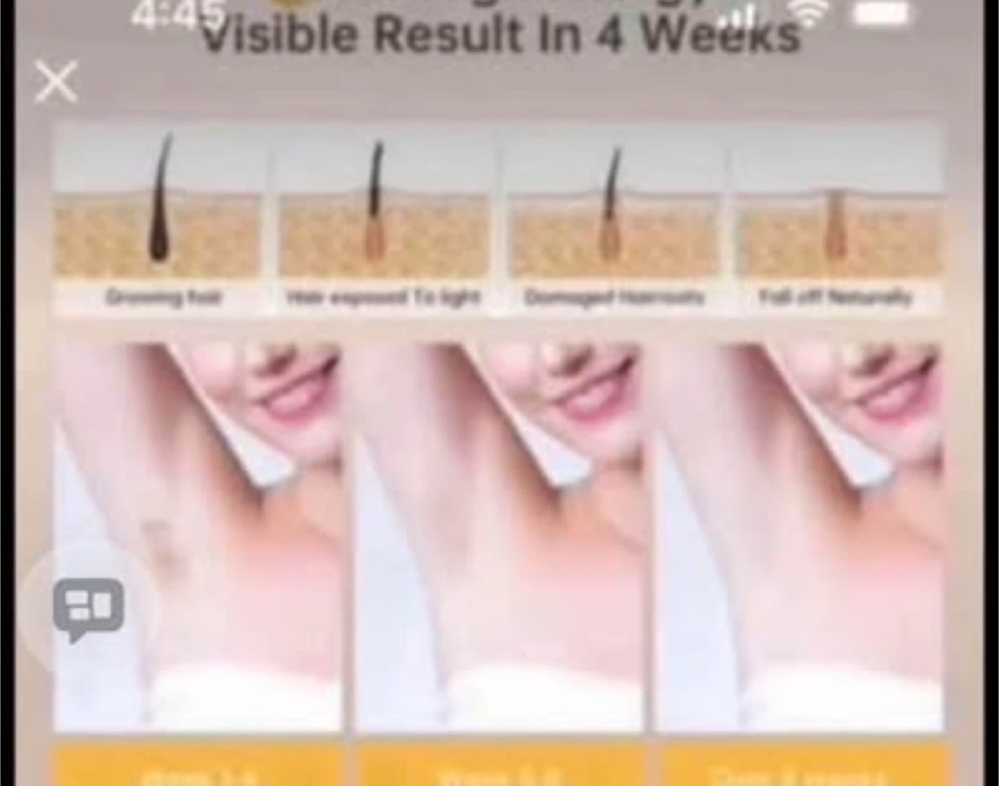IPL Hair Removal Device - photo 5