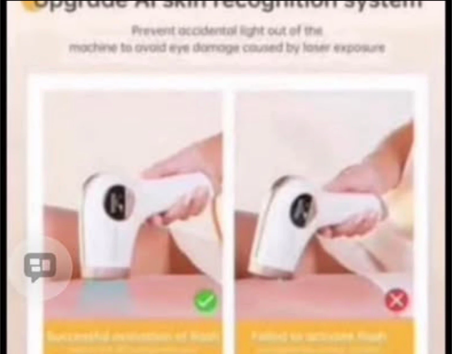 IPL Hair Removal Device - photo 4