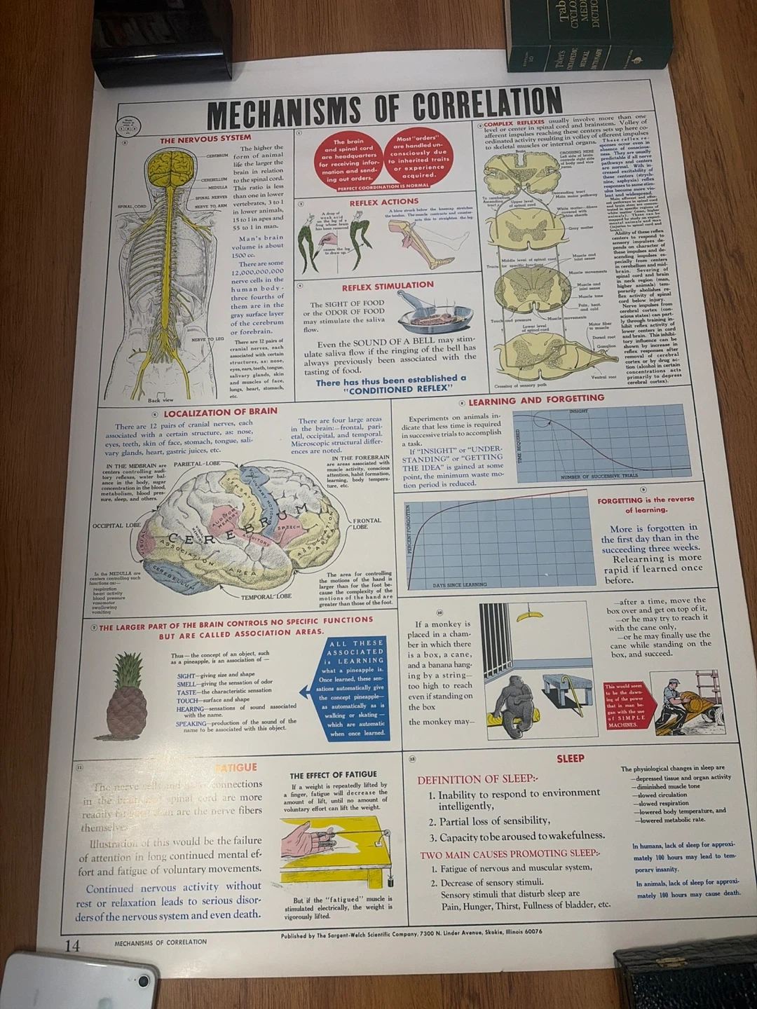 Vintage. Brain poster- Mechanisms of Correlation