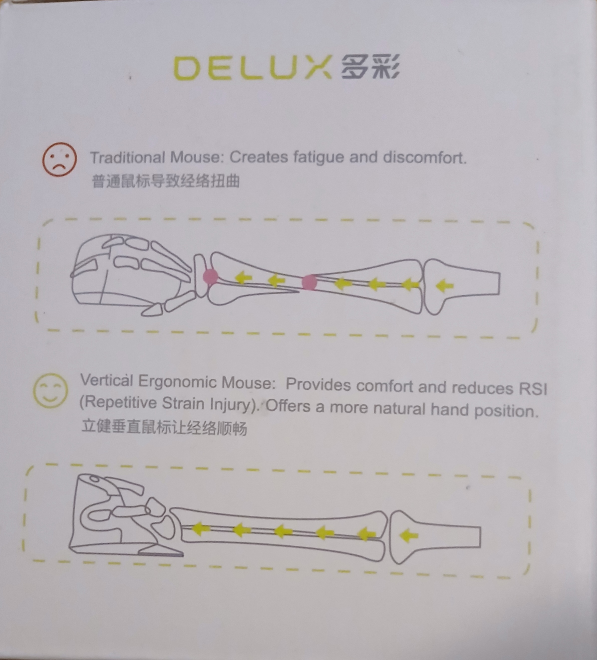 Delux M618 Ergonomic Vertical Mouse - photo 2
