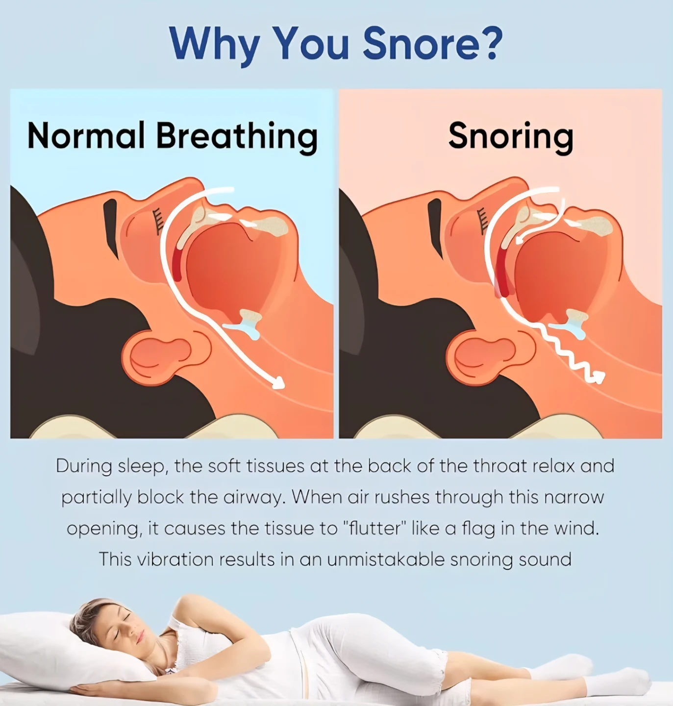 Anti Snoring Device - photo 2