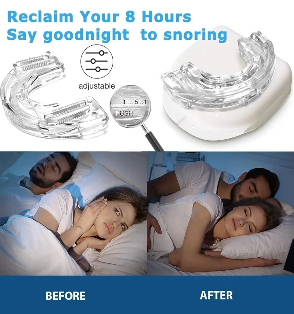 Anti Snoring Device - photo 3