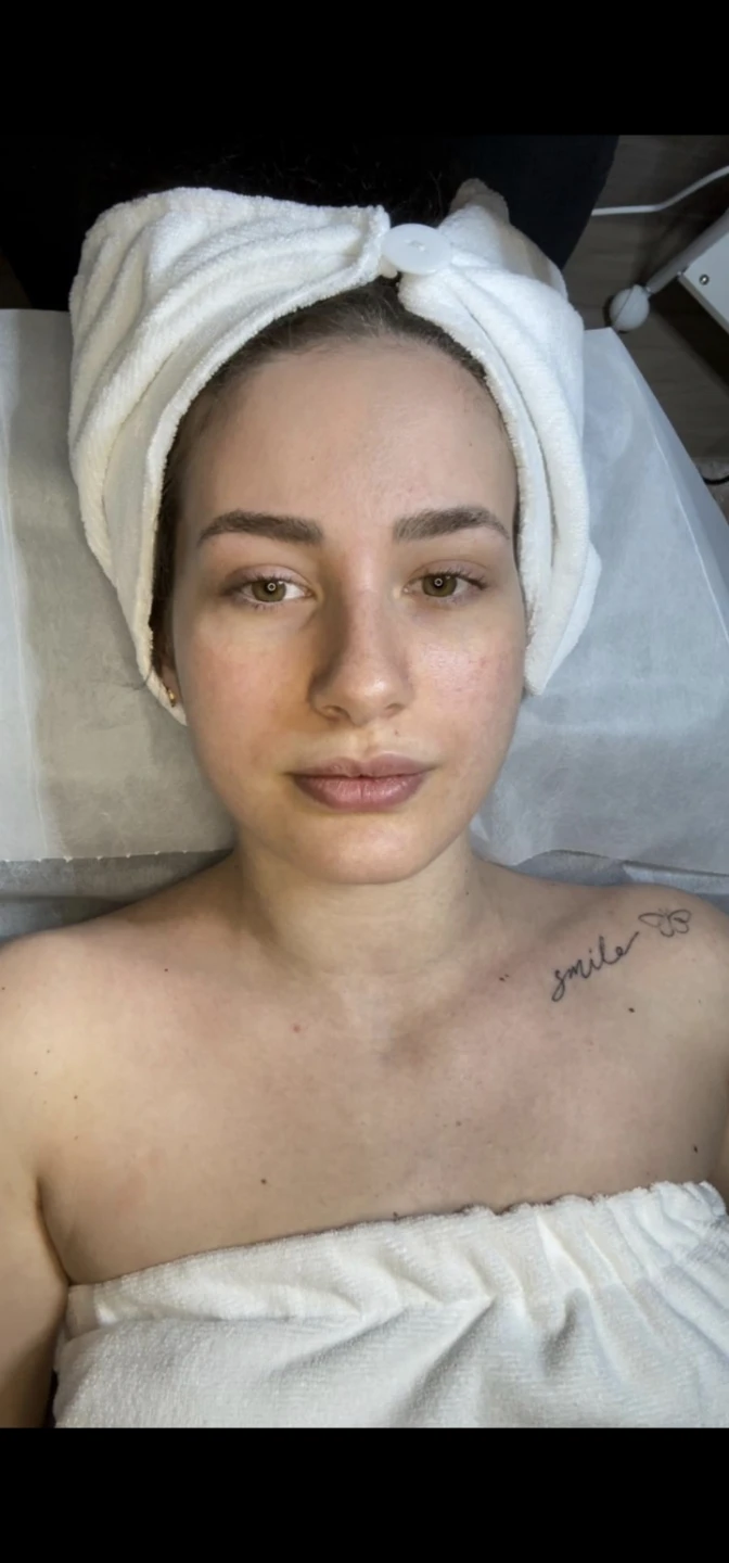 Ruby Beauty Custom European Facial - photo 2