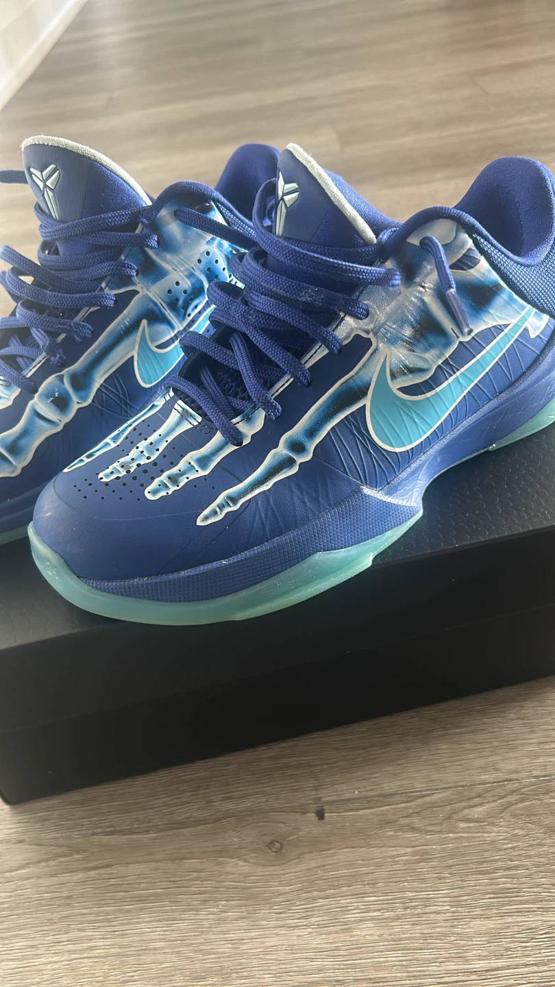 Kobe 5 X-ray
