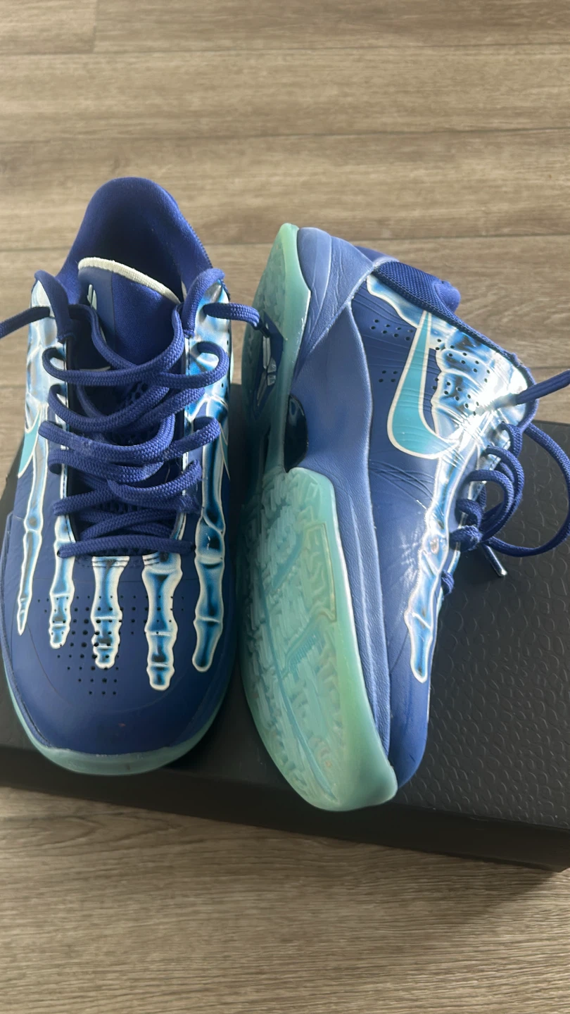 Kobe 5 X-ray - photo 3