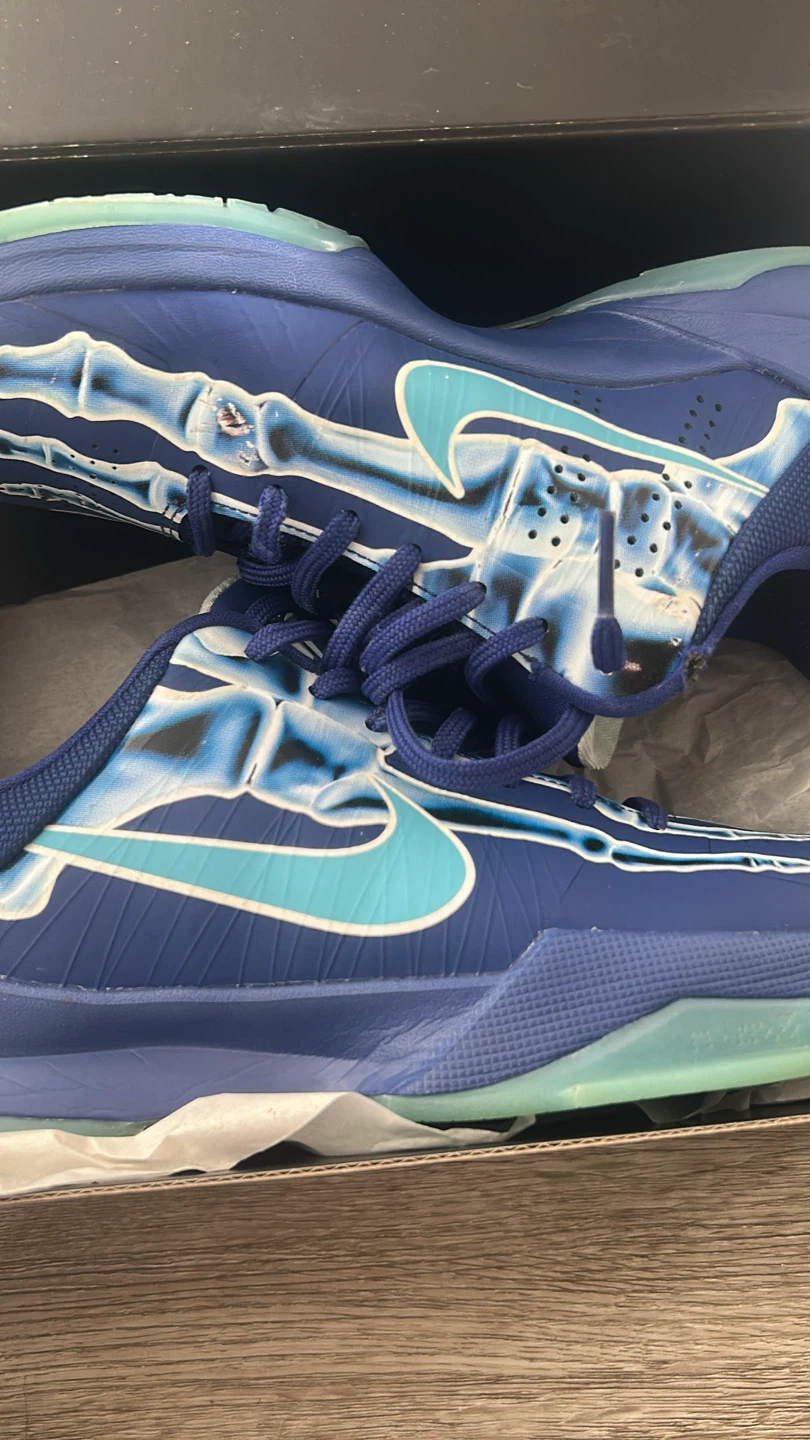 Kobe 5 X-ray - photo 2