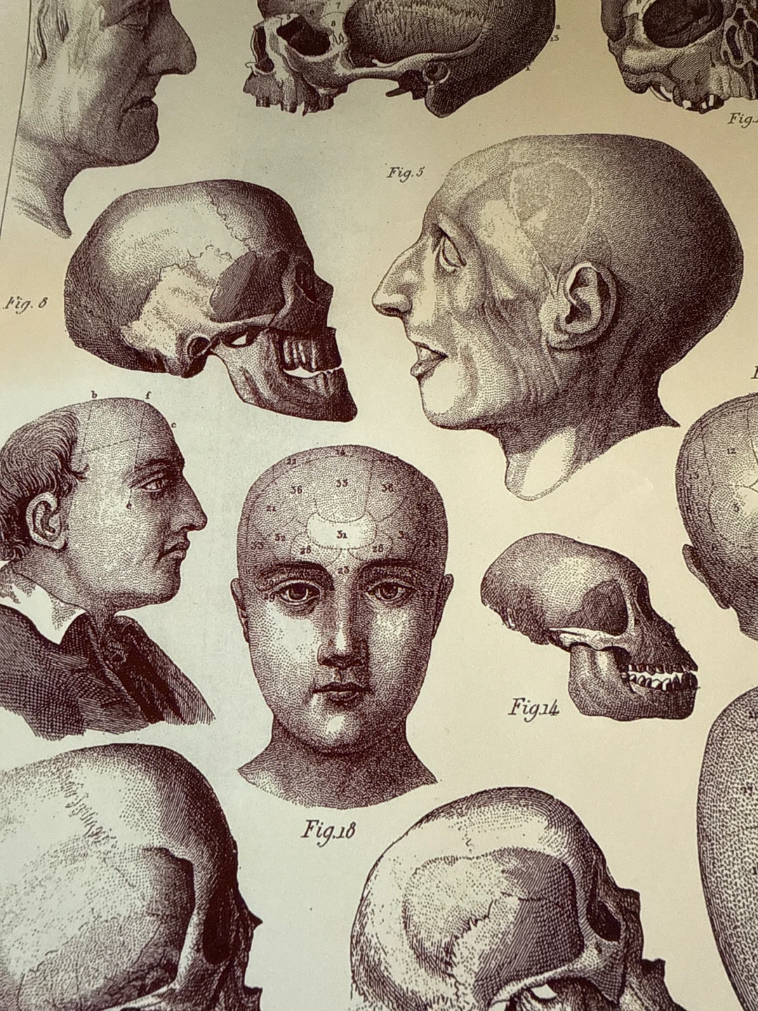 Vintage Anatomical Skull Illustrations Print - photo 2