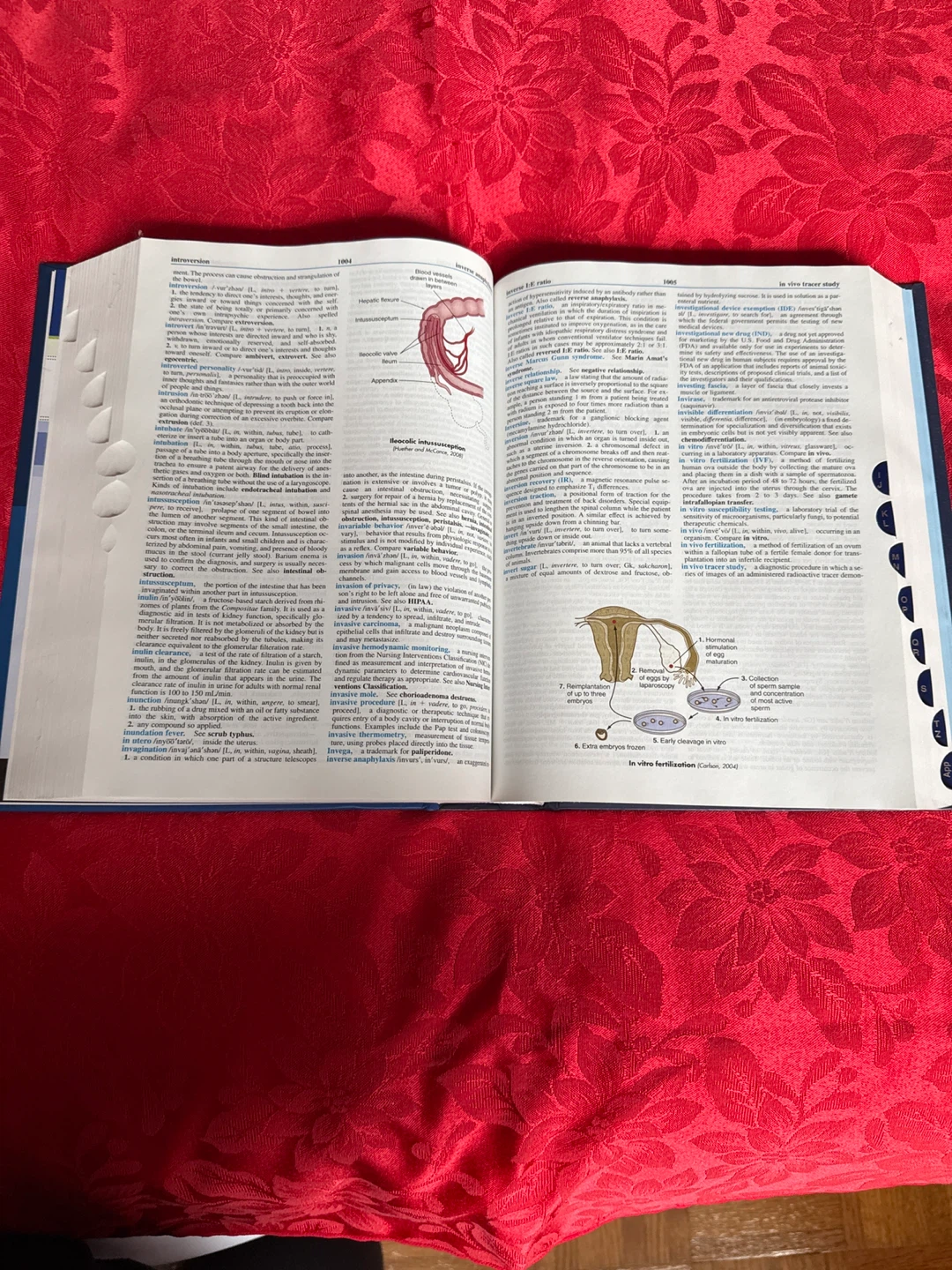 Mosby's Dictionary of Medicine, Nursing & Health Professions - photo 5
