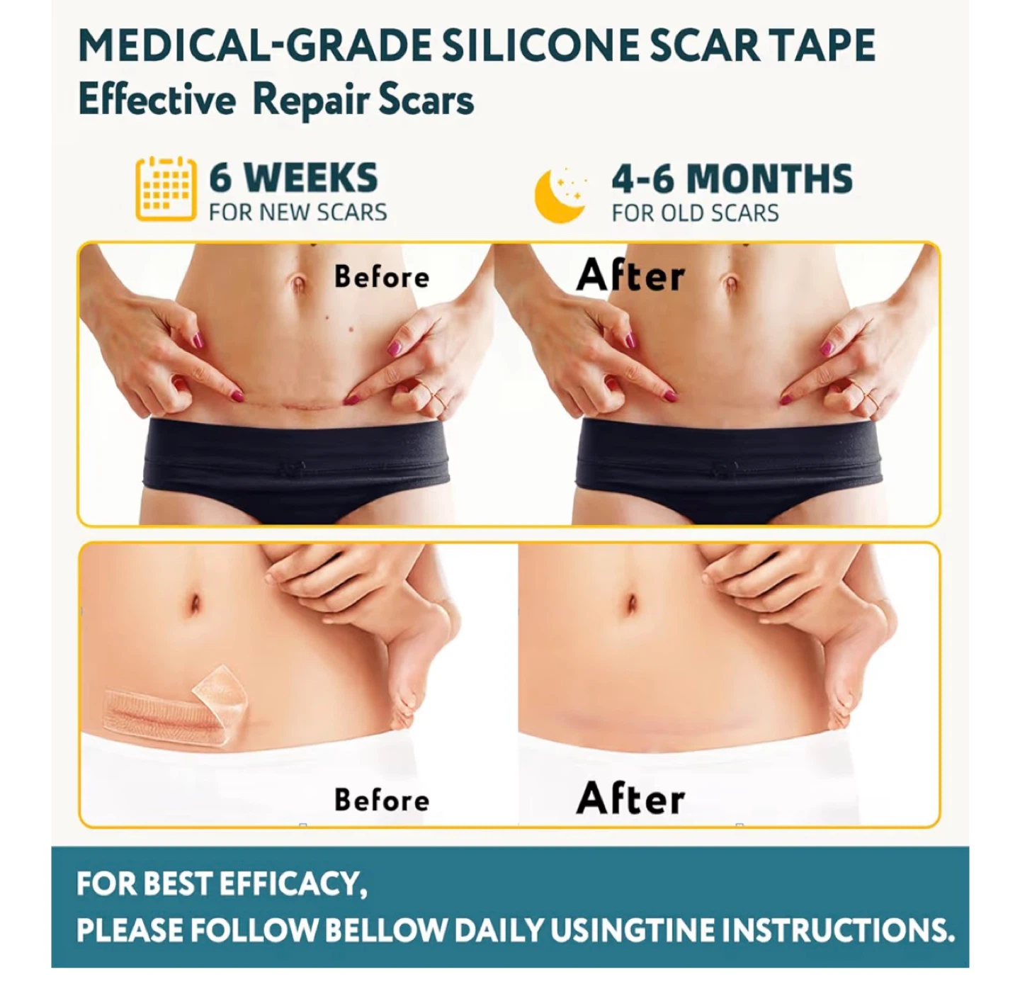 RWT Silicone Scar Tape - 150 cm x 4 cm - photo 4