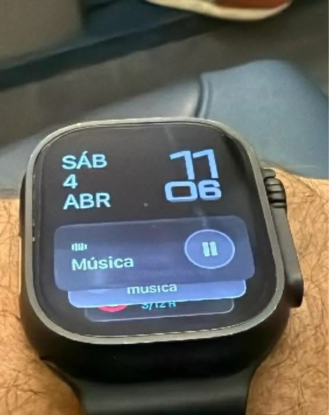 Apple Watch