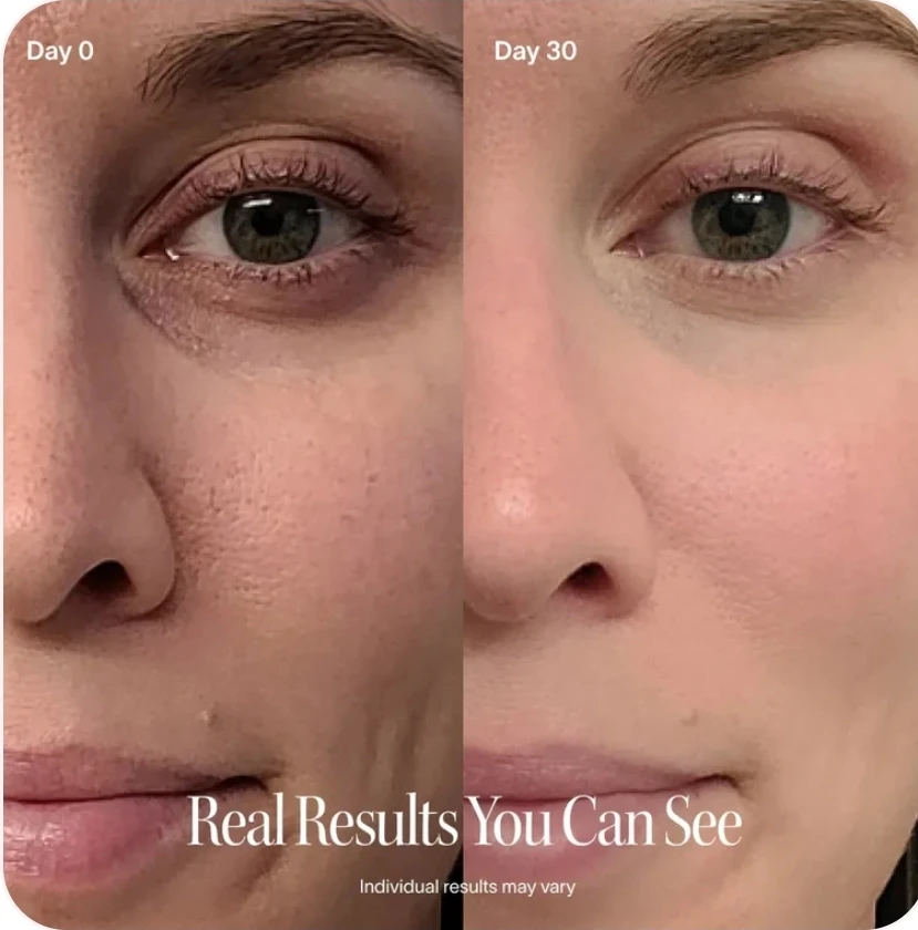 Solawave Advanced Skincare Wand - photo 5