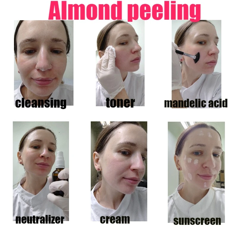 Almond Peeling Skincare Set