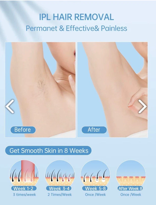 IPL Hair Removal Device with Cooling System - White - photo 3