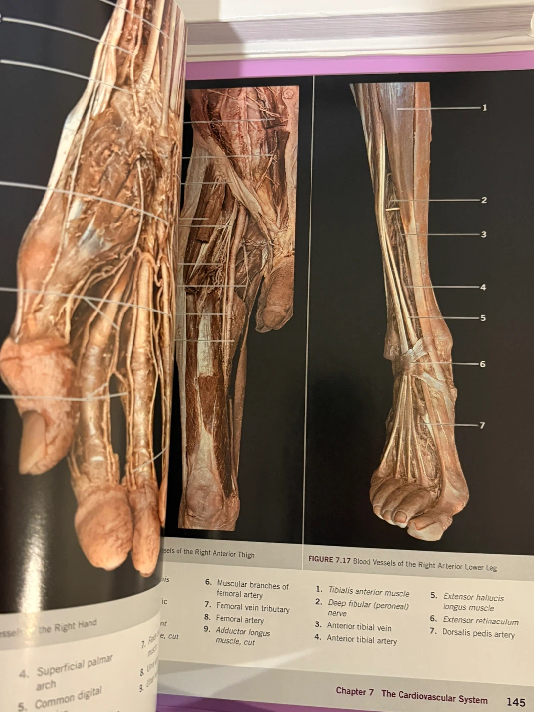 A Photographic Atlas for Anatomy & Physiology Textbook - photo 3