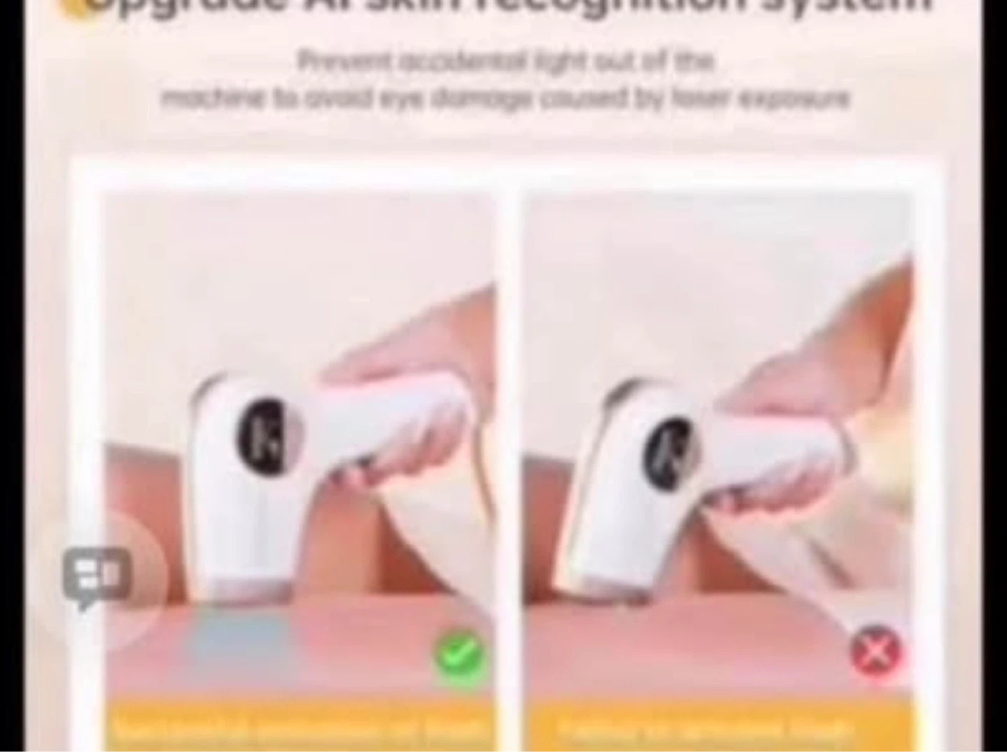 Laser Hair Removal
