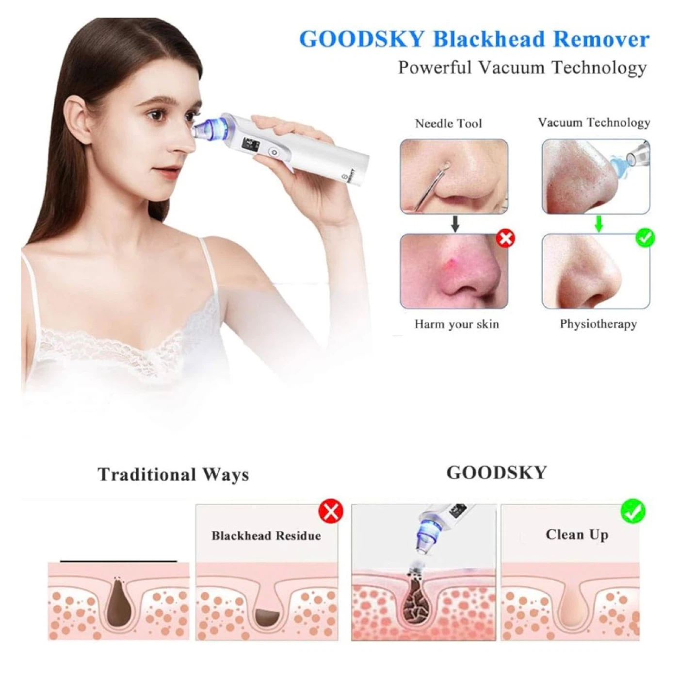 Blackhead remover - photo 2