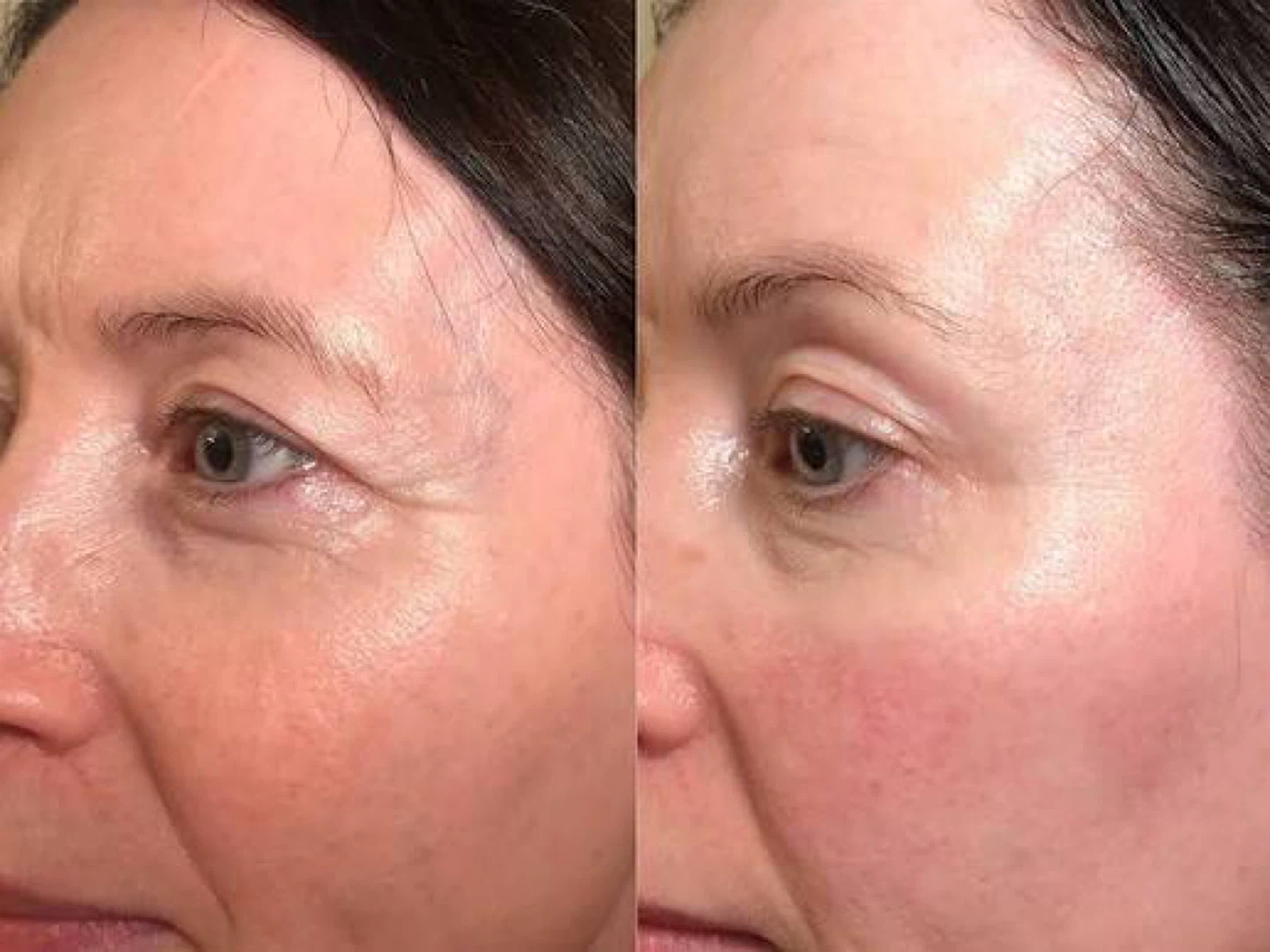 Naturelle Spa Facial Sculpting Massage - photo 2