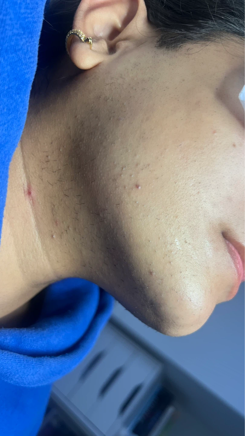Electrolysis & Permanent Hair Remova - photo 2