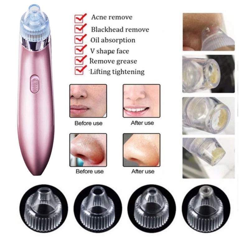 Pore Vacuum Cleaner with Multiple Heads - photo 2