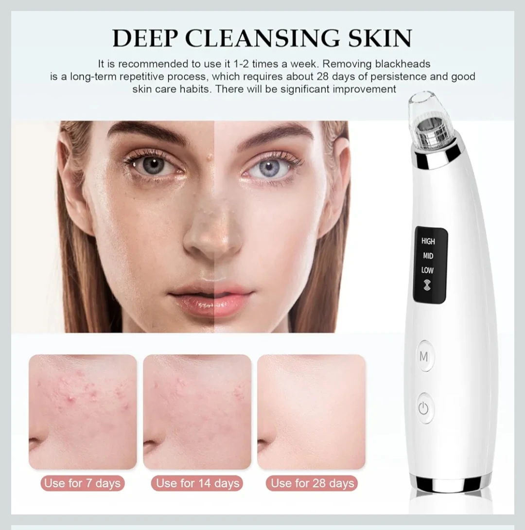 Blackhead Remover Vacuum pores blackhead deep facial cleaning