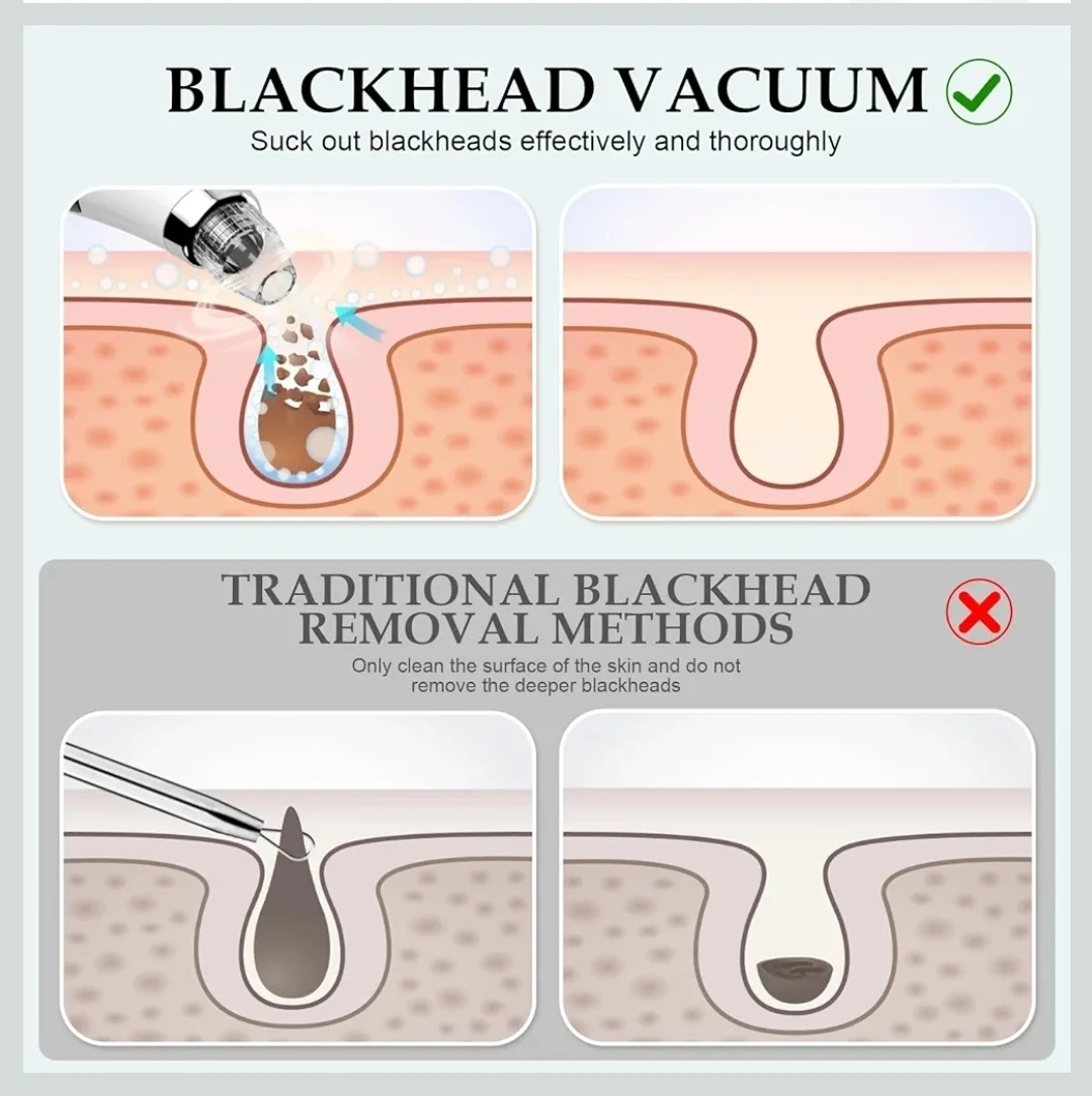 Blackhead Remover Vacuum pores blackhead deep facial cleaning - photo 5