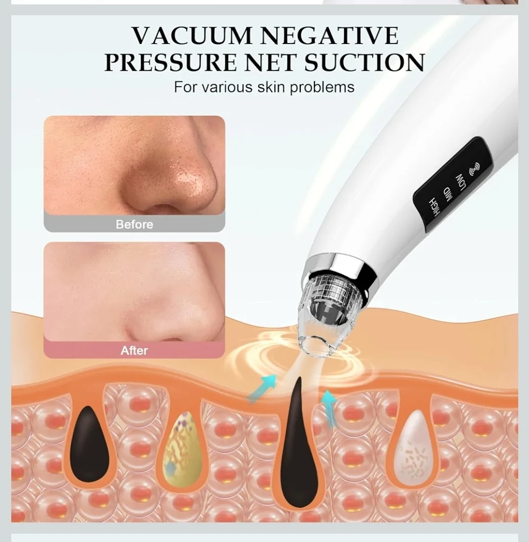 Blackhead Remover Vacuum pores blackhead deep facial cleaning - photo 2