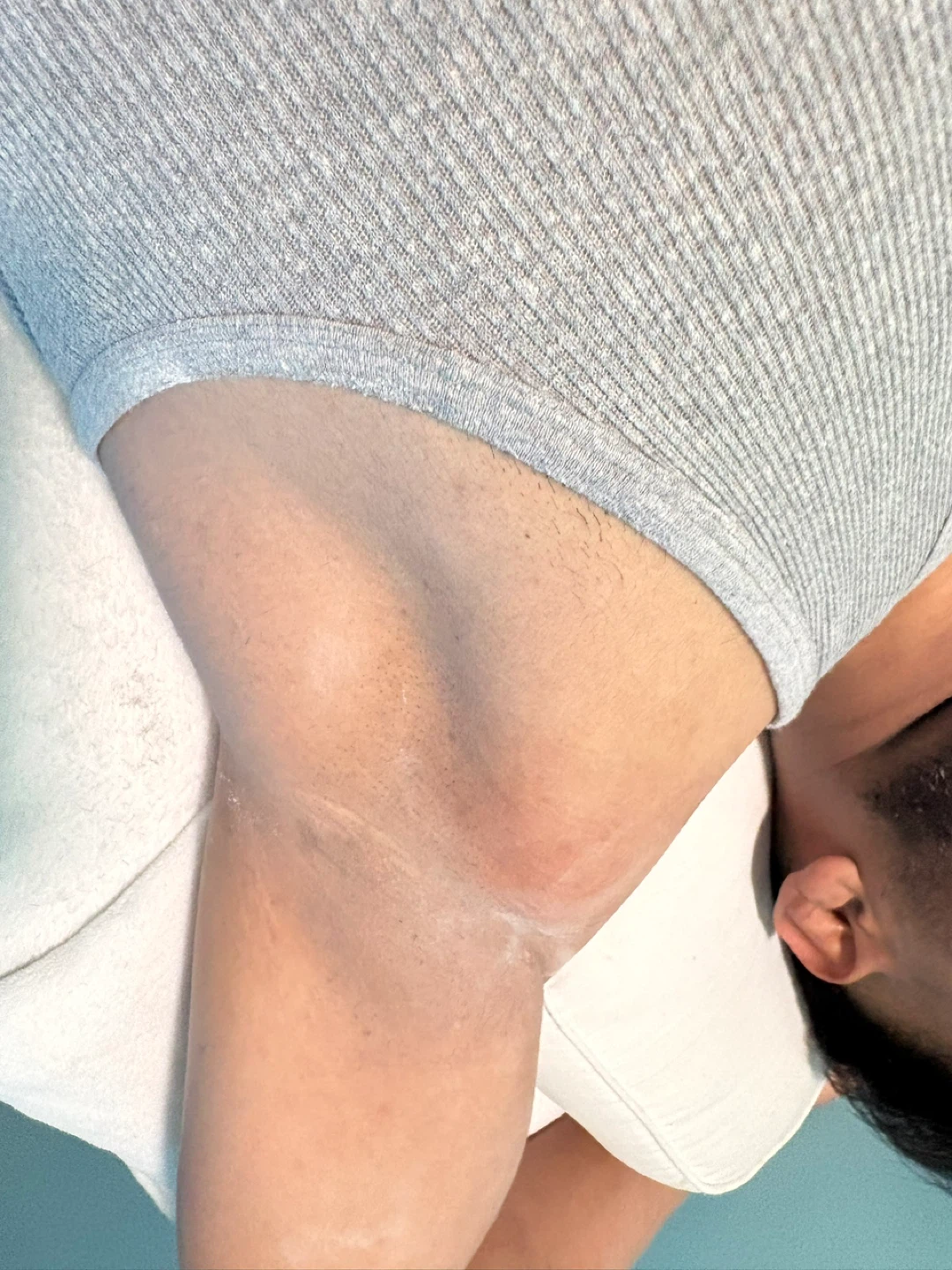 Tao Nails Laser Hair Removal Service - photo 2