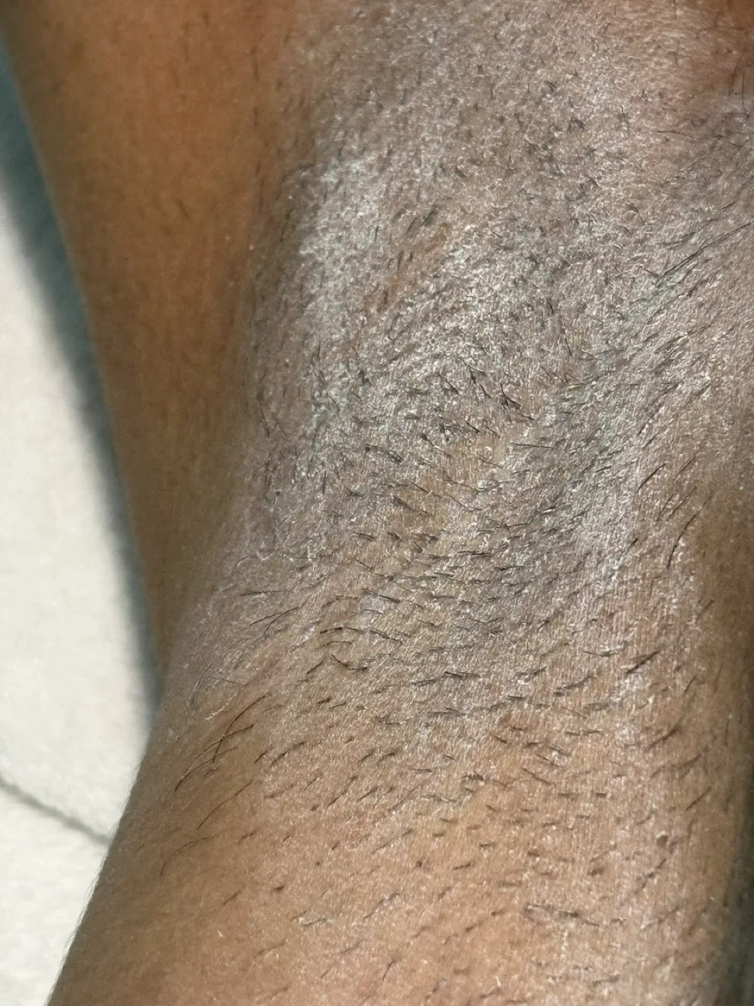 Tao Nails Laser Hair Removal Service