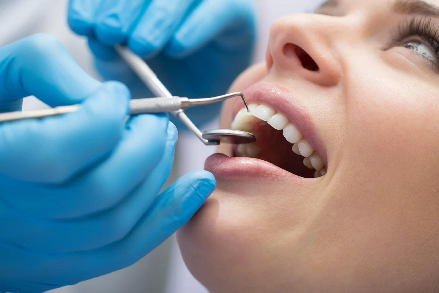 PATIENTS NEEDED FOR DENTAL CLEANING – FREE NEEDED