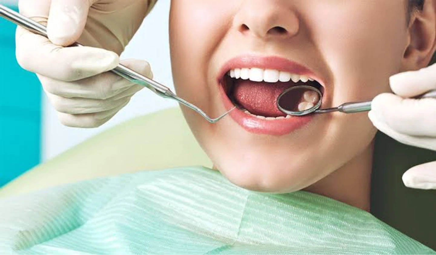 PATIENTS NEEDED FOR DENTAL CLEANING – FREE NEEDED - photo 2