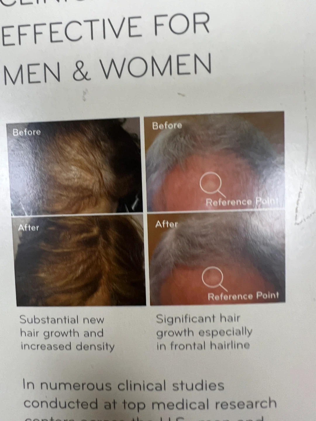 HairMax Premium Lux 9 LaserComb Hair Growth Device - photo 2