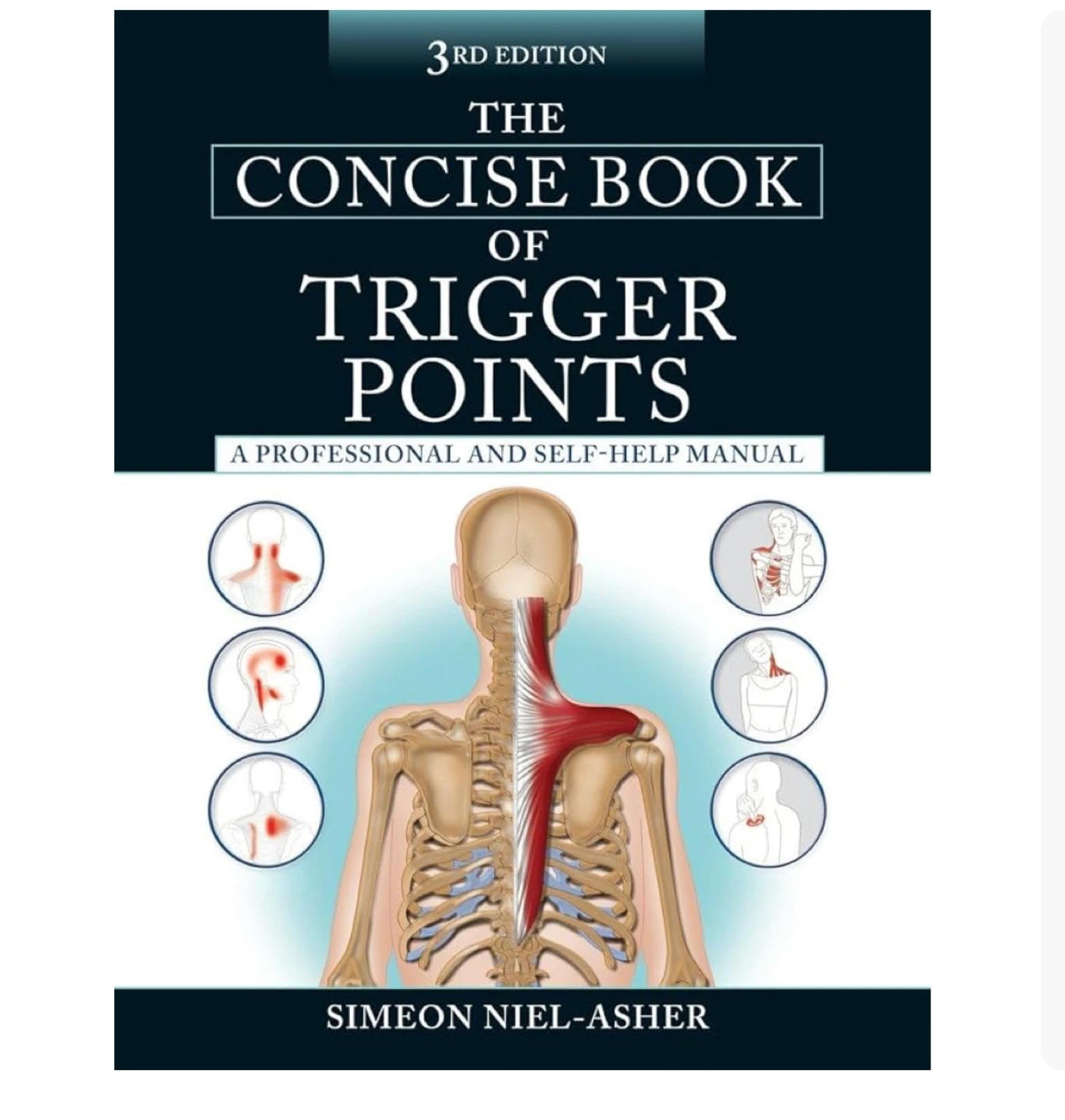 The Concise Book of Trigger Points 3rd Edition