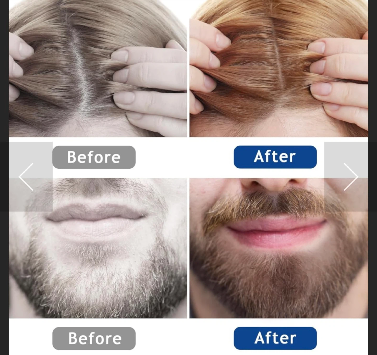 Hair growth - photo 5