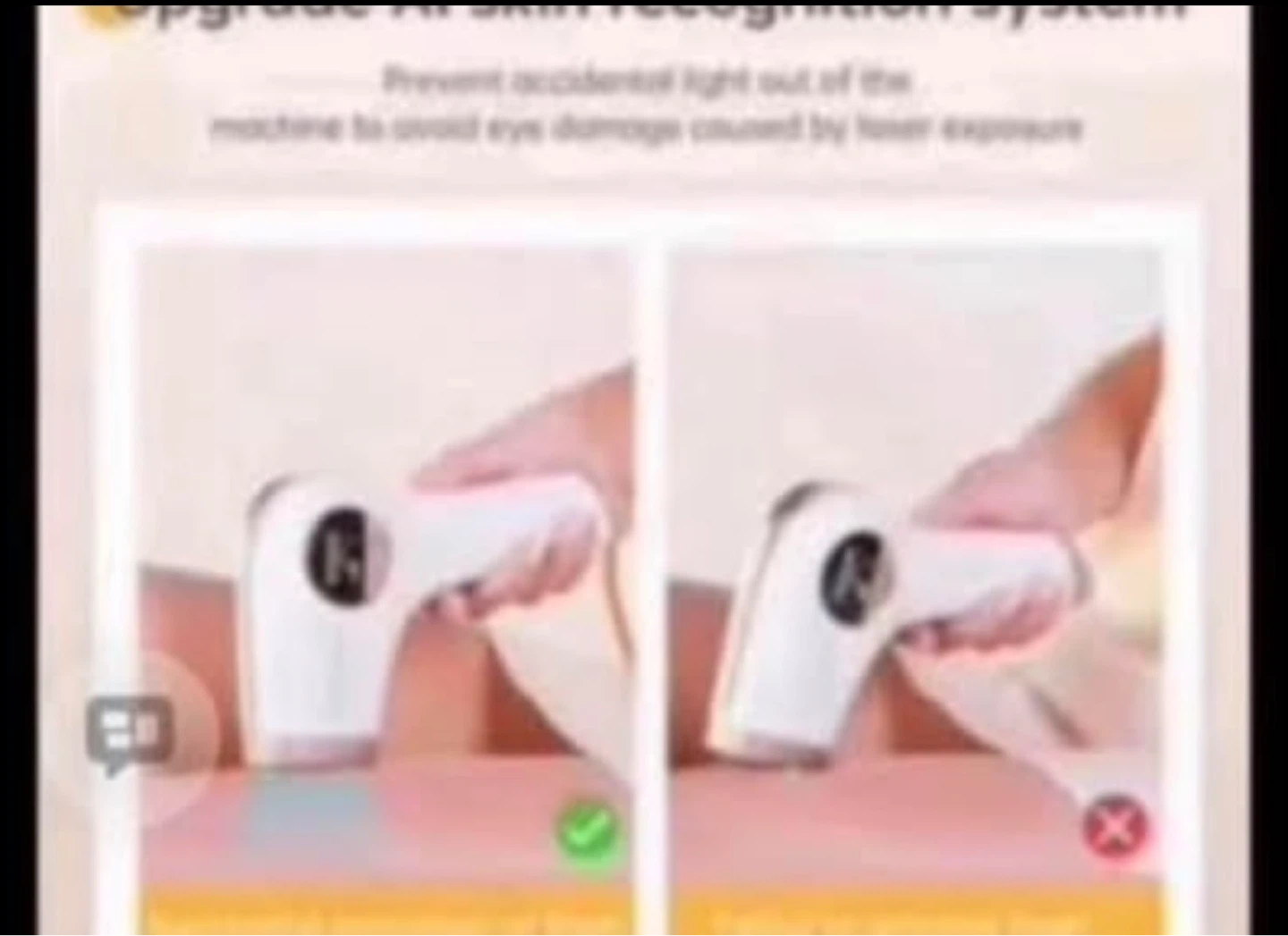 Intense Pulsed Light Hair Removal Device
