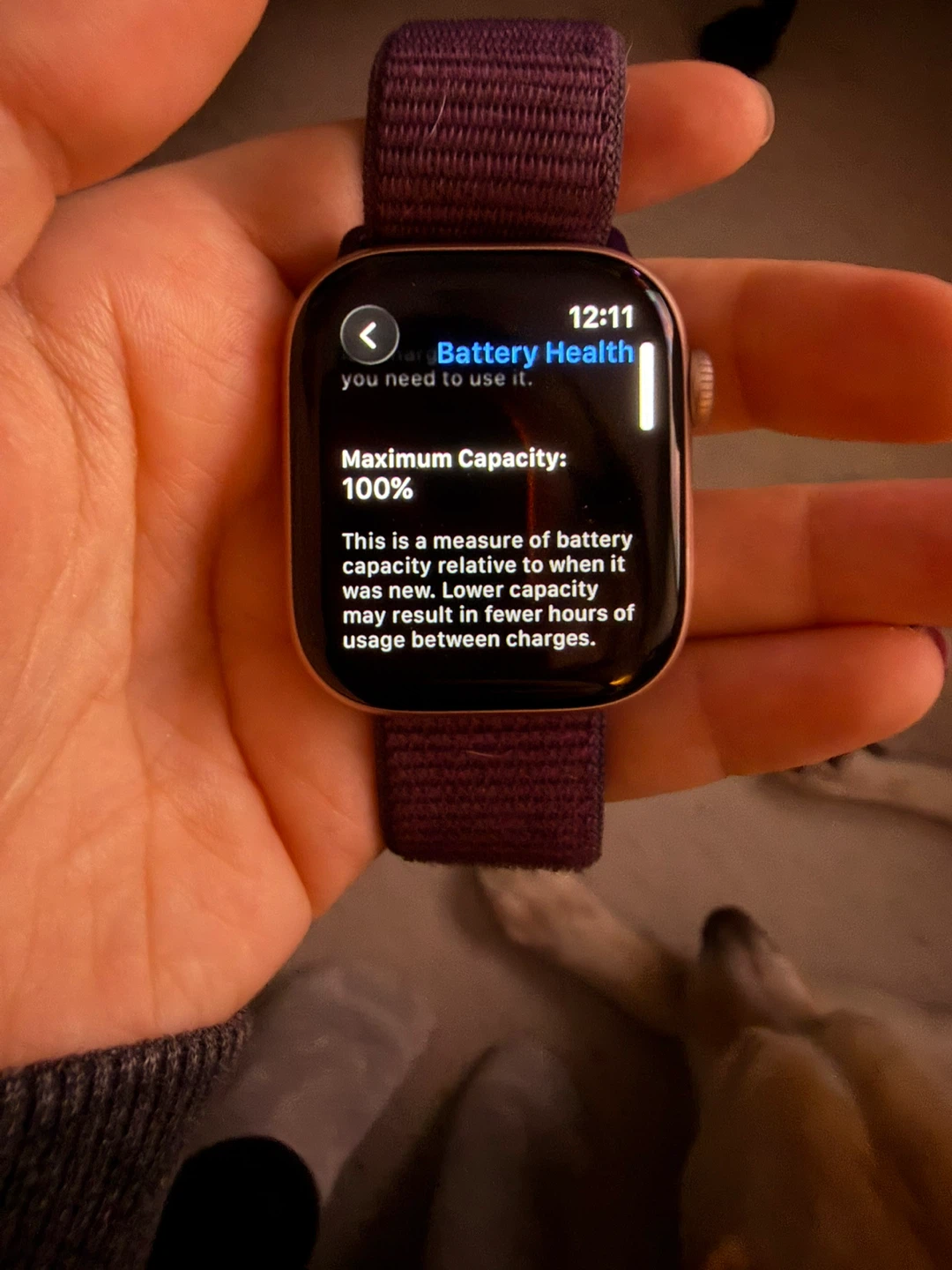 Apple Watch series 10 - photo 4