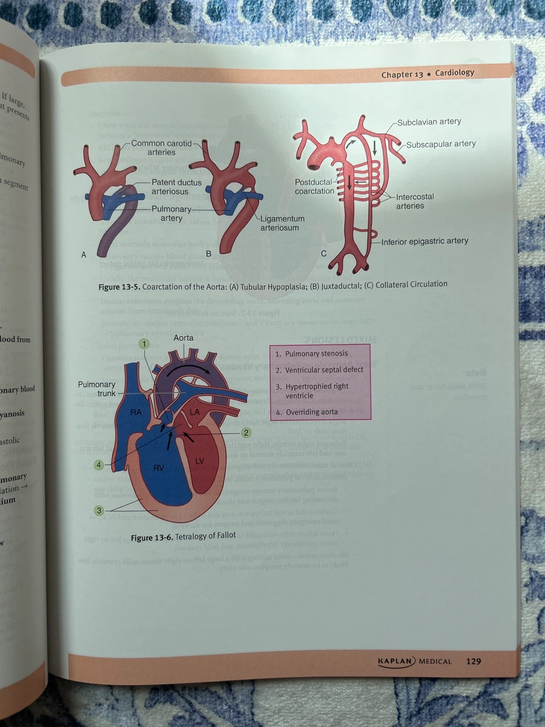 (Paperback) MCCQE/USMLE Step 2 CK Lecture Notes - Peds - photo 2