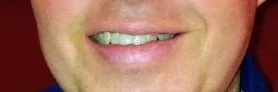 ⚽ Free Arm & Hammer Spinbrush Whitening Toothbrush - photo 4
