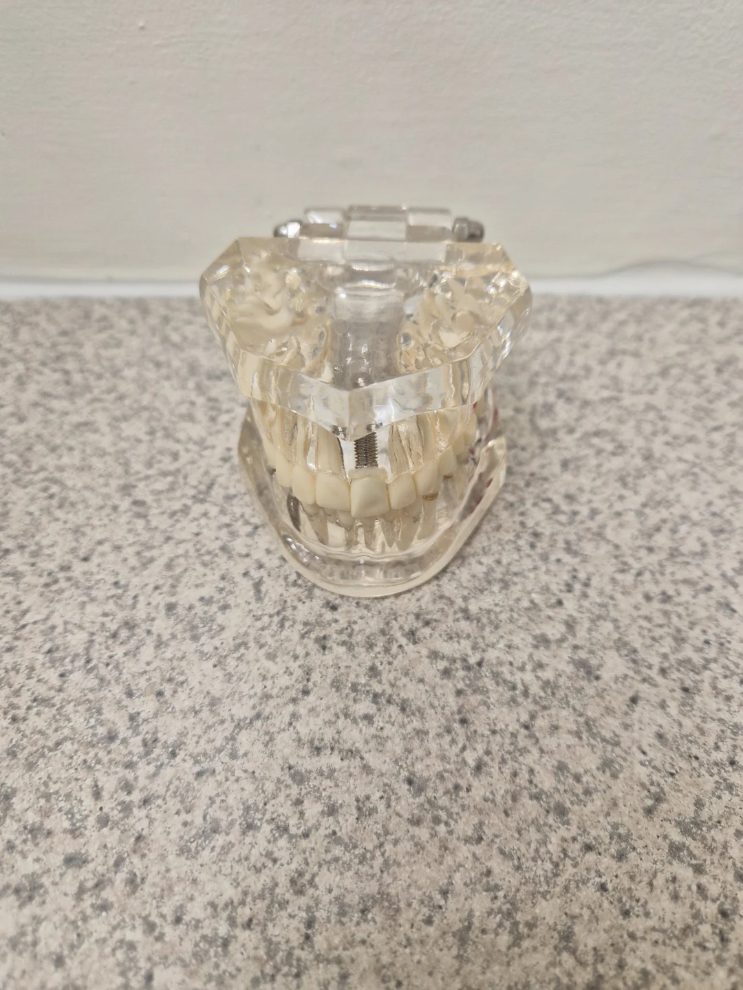 Dental Implant Training Model / Demonstration Model – $15