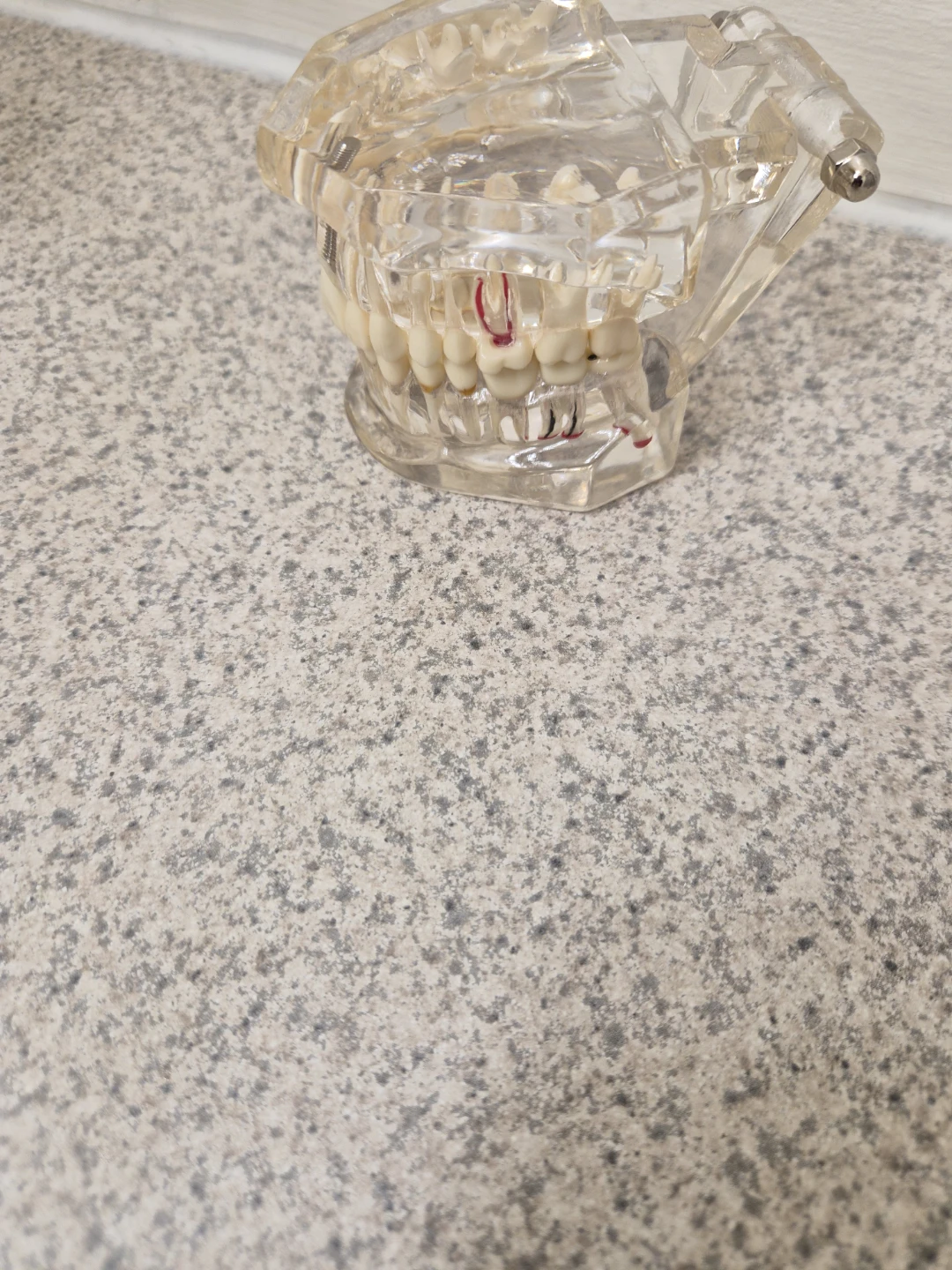 Dental Implant Training Model / Demonstration Model – $15 - photo 3